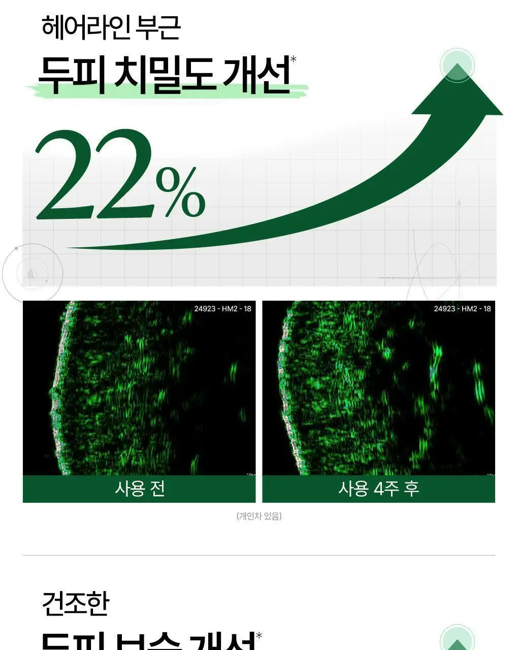 [두피활력 & 모발강화] 클로란 퀴닌 에델바이스 샴푸 더블 기획 (400ml 2입기획) 상세페이지 9